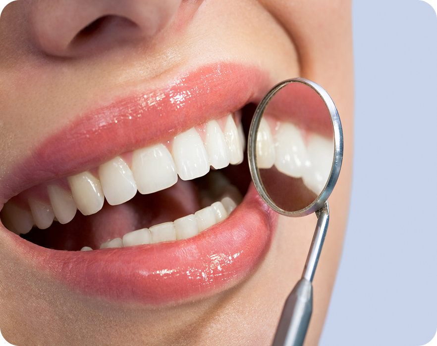 Tratamento periodontal em Brasília